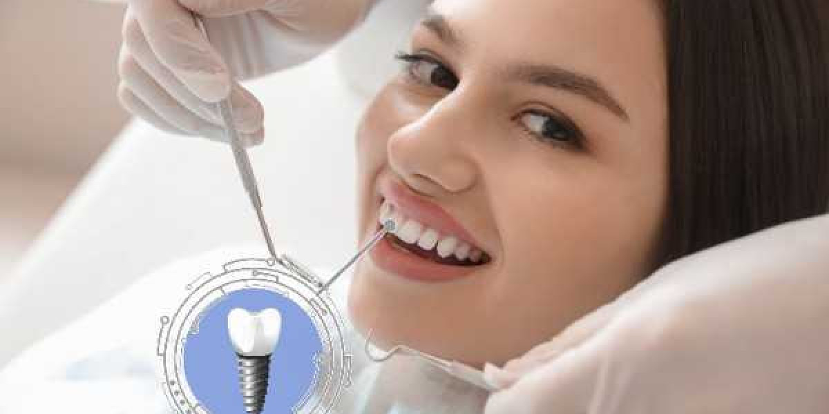 Quick Relief and Lasting Solutions with Emergency Dental Implants